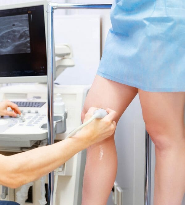 varicose vein removal treatment