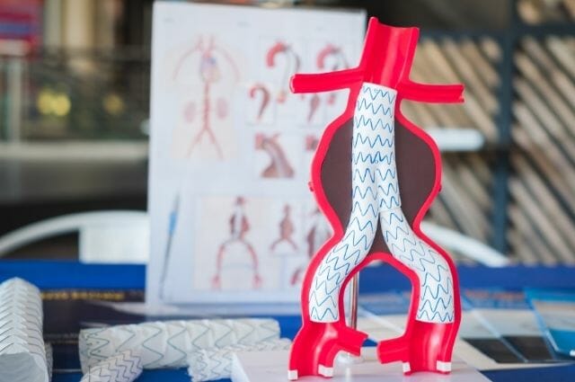 aortic stent graft model