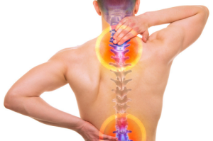 TREATMENT FOR NERVE COMPRESSION IN THE BACK