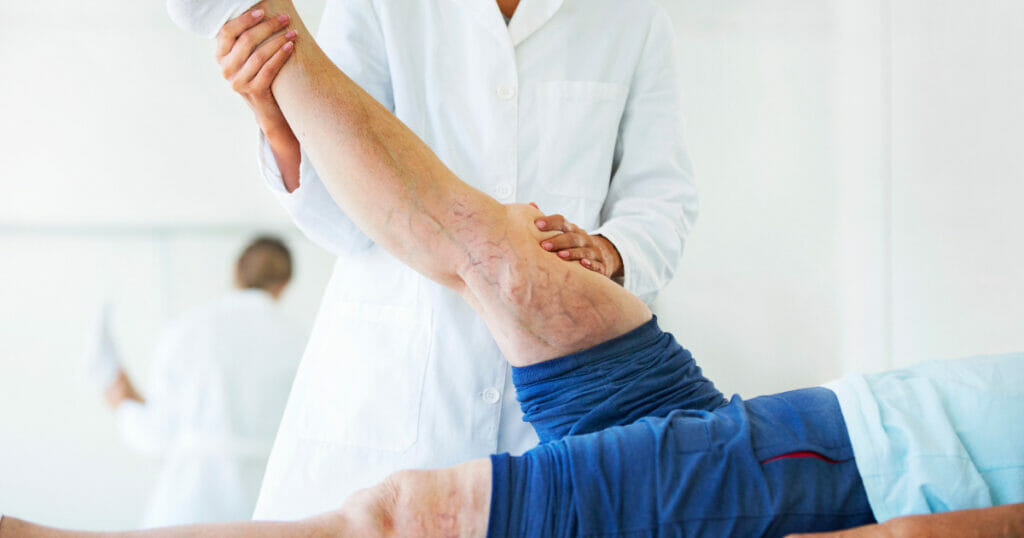 what is sclerotherapy