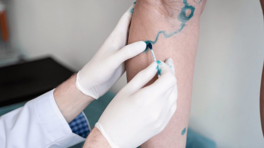 doctor drawing on a patient's leg for diagnosis