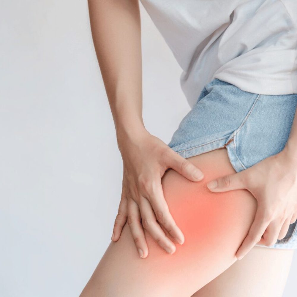 Upper Thigh Blood Clot: Signs, Causes, and When to Act